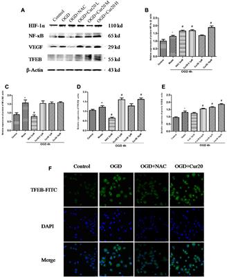 Curcumin Derivative Cur20 Attenuated Cerebral Ischemic Injury by Antioxidant Effect and HIF-1α/VEGF/TFEB-Activated Angiogenesis